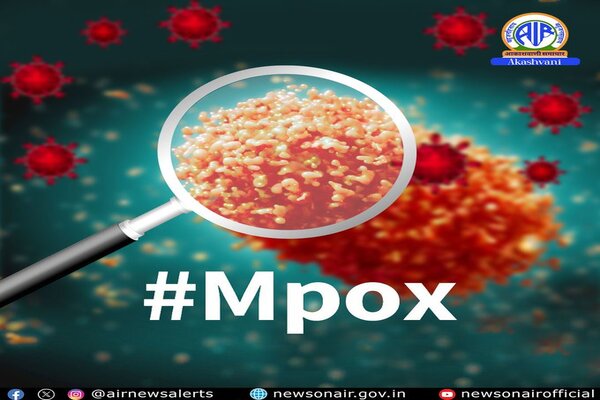 Centre asks States and UTs for screening and testing of all suspect cases of Mpox